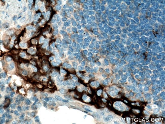 PD-L1/CD274 Antibody in Immunohistochemistry (Paraffin) (IHC (P))