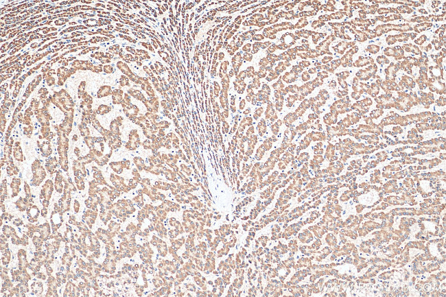 SEC22C Antibody in Immunohistochemistry (Paraffin) (IHC (P))