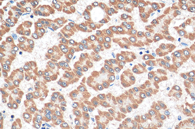 SEC22C Antibody in Immunohistochemistry (Paraffin) (IHC (P))