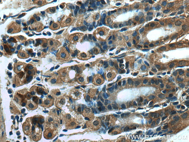 RSAD2 Antibody in Immunohistochemistry (Paraffin) (IHC (P))