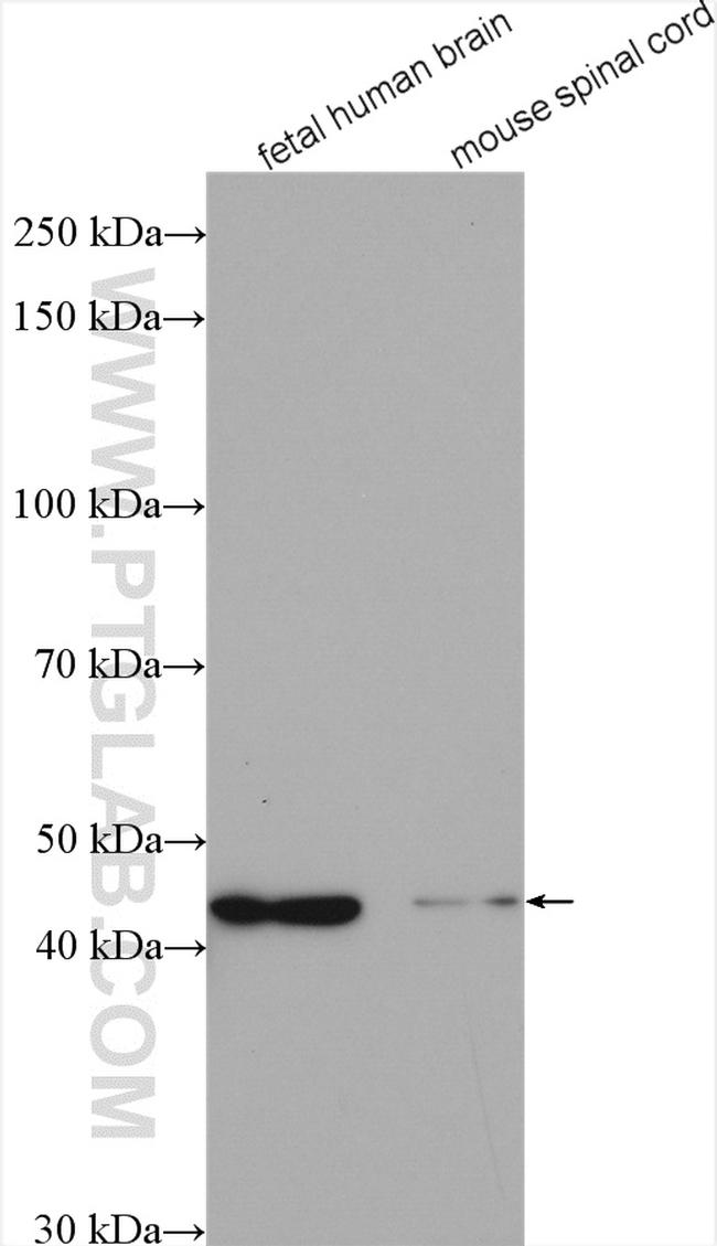 RSAD2 Antibody in Western Blot (WB)