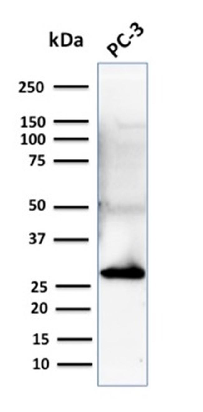 14-3-3 Sigma/Stratifin Antibody in Western Blot (WB)
