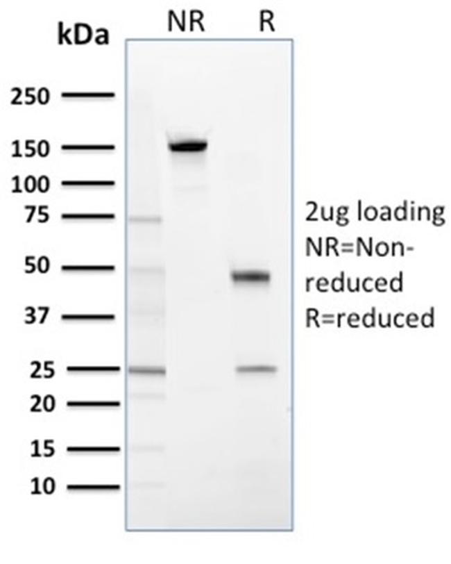 14-3-3 Sigma/Stratifin Antibody in SDS-PAGE (SDS-PAGE)