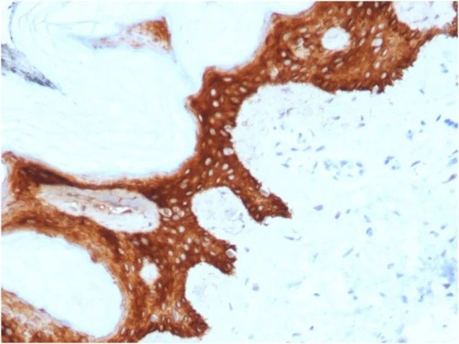 14-3-3 Sigma/Stratifin Antibody in Immunohistochemistry (Paraffin) (IHC (P))