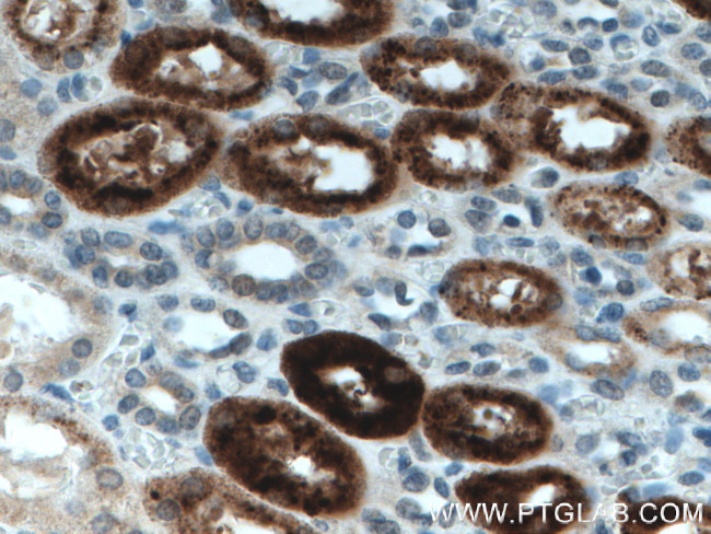 KL Antibody in Immunohistochemistry (Paraffin) (IHC (P))