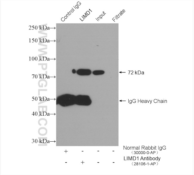 LIMD1 Antibody in Immunoprecipitation (IP)