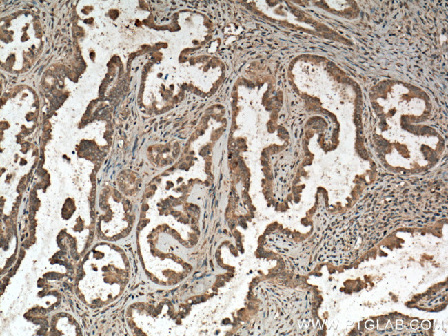 CDC25B Antibody in Immunohistochemistry (Paraffin) (IHC (P))