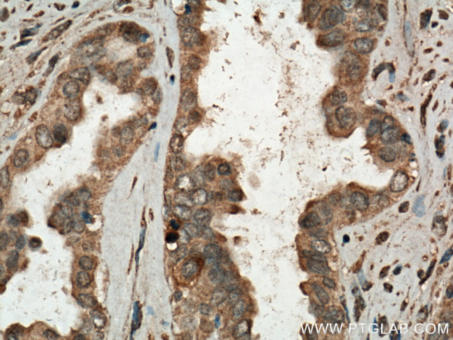 CDC25B Antibody in Immunohistochemistry (Paraffin) (IHC (P))