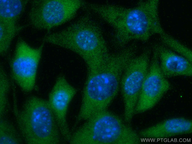 AKT2 Antibody in Immunocytochemistry (ICC/IF)