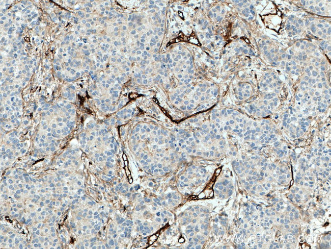 Endoglin/CD105 Antibody in Immunohistochemistry (Paraffin) (IHC (P))