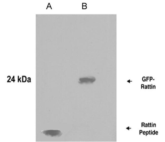 Rattin Antibody in Western Blot (WB)