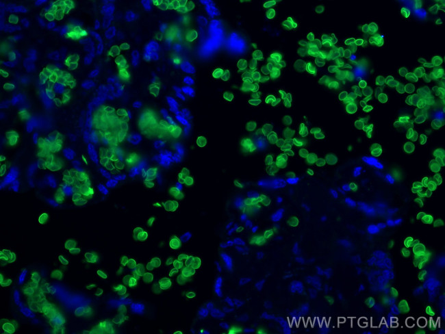 SLC4A1 Antibody in Immunohistochemistry (PFA fixed) (IHC (PFA))