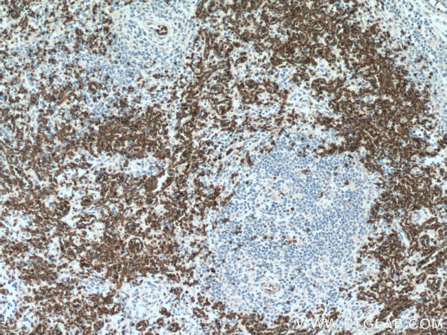 SLC4A1 Antibody in Immunohistochemistry (Paraffin) (IHC (P))