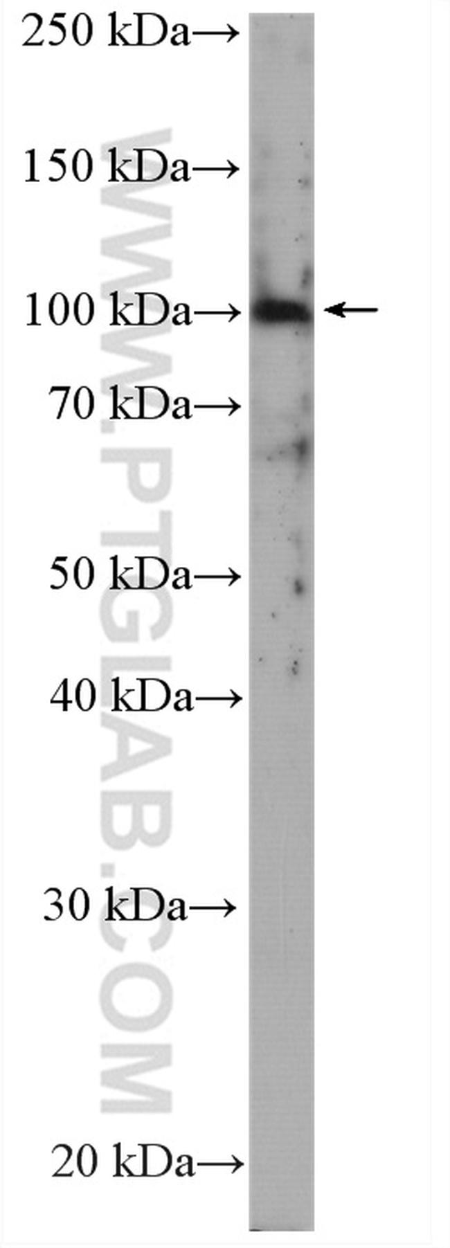 SLC4A1 Antibody in Western Blot (WB)