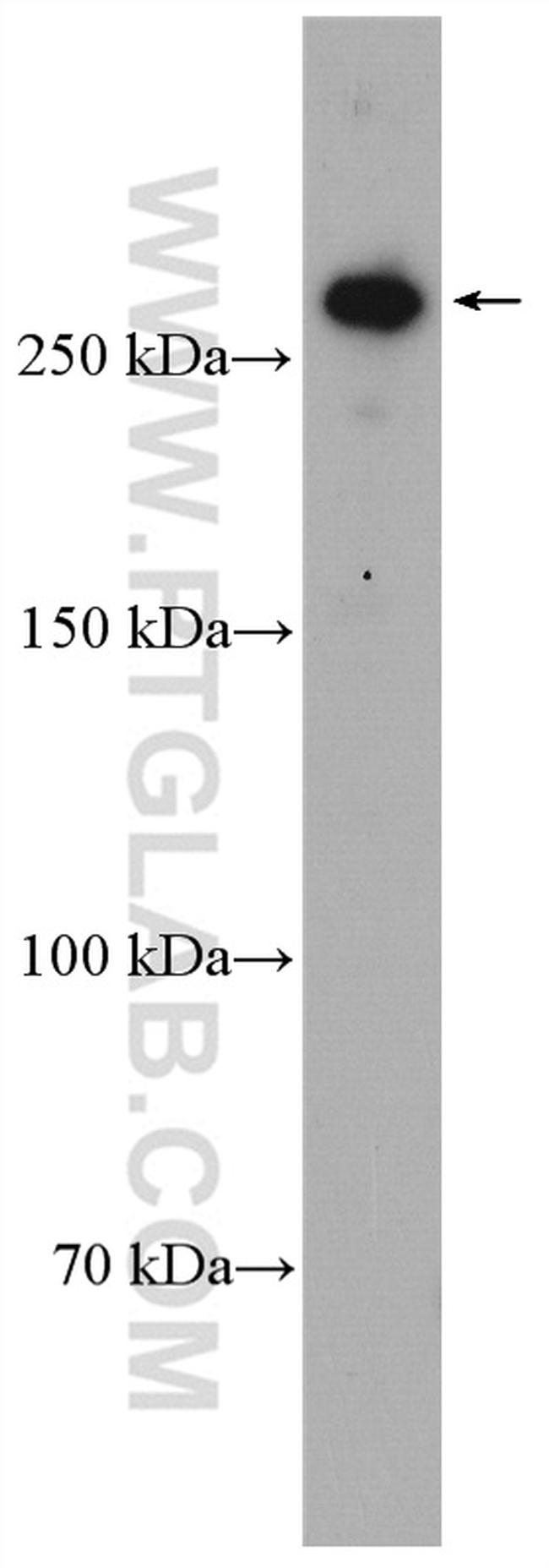 CENPE Antibody in Western Blot (WB)