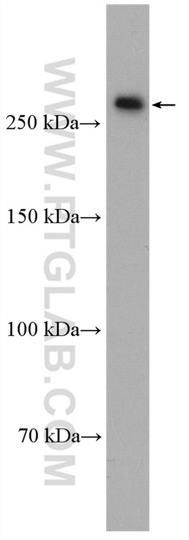 CENPE Antibody in Western Blot (WB)