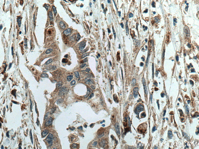 SGSH Antibody in Immunohistochemistry (Paraffin) (IHC (P))