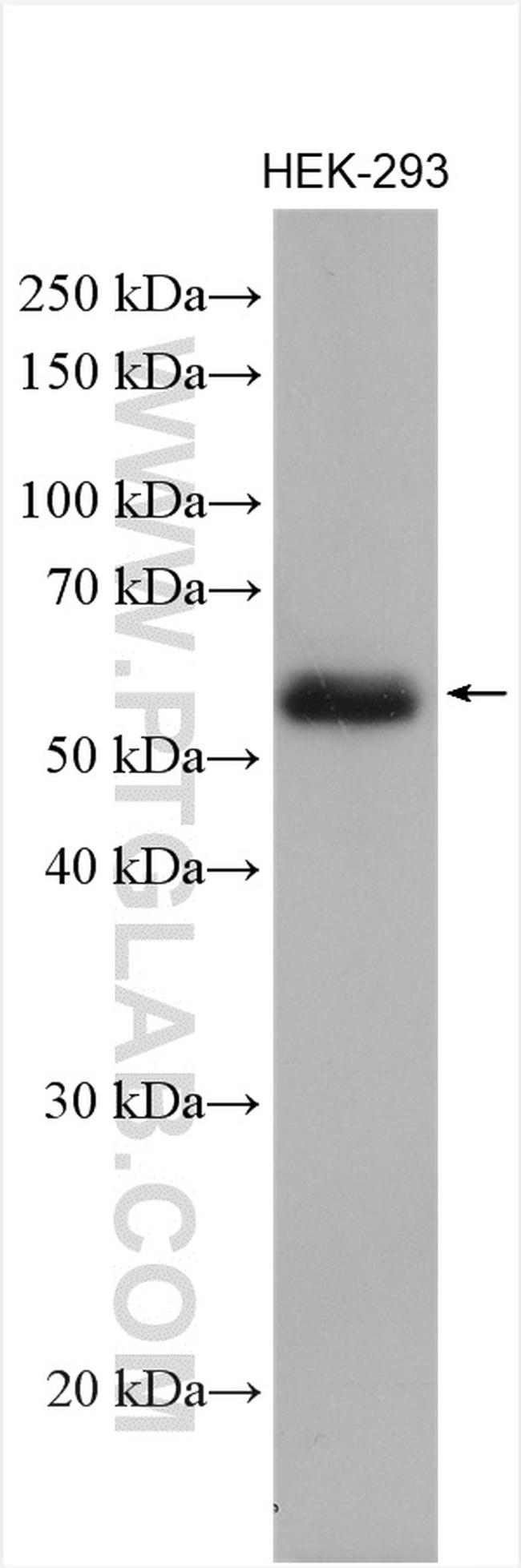 SGSH Antibody in Western Blot (WB)