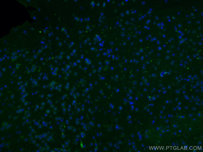 NET1 Antibody in Immunohistochemistry (Paraffin) (IHC (P))