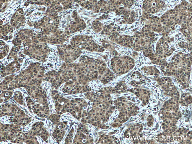 NET1 Antibody in Immunohistochemistry (Paraffin) (IHC (P))