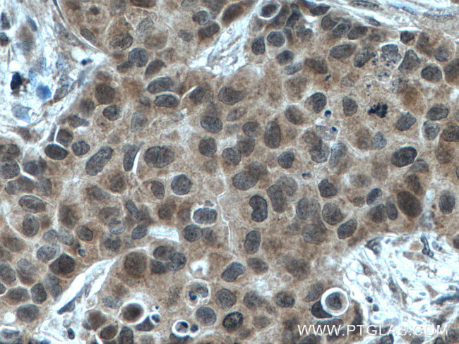 NET1 Antibody in Immunohistochemistry (Paraffin) (IHC (P))