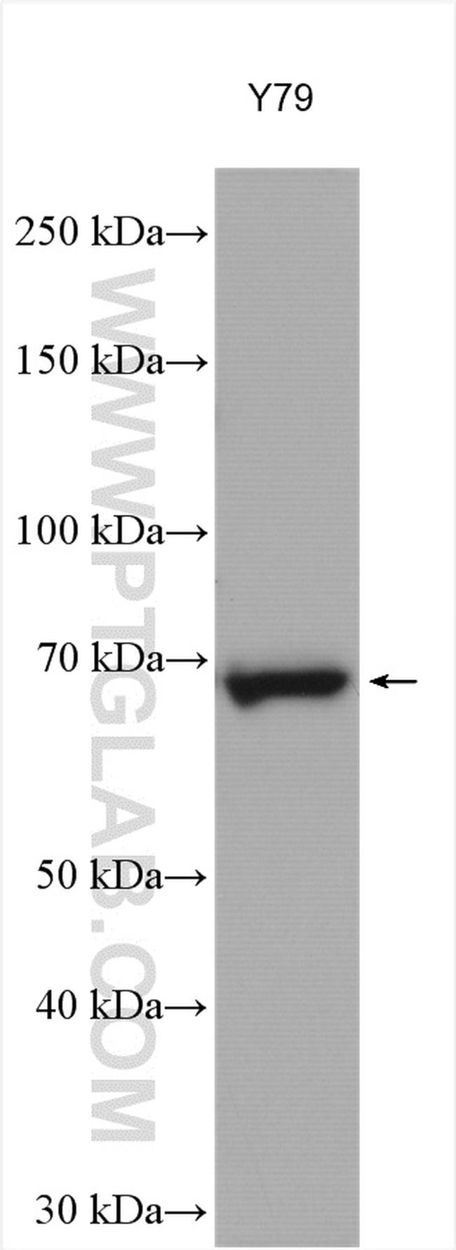 NET1 Antibody in Western Blot (WB)