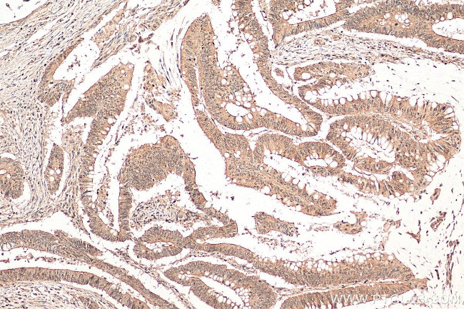 WBSCR22 Antibody in Immunohistochemistry (Paraffin) (IHC (P))