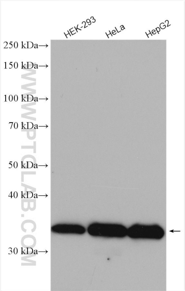 WBSCR22 Antibody in Western Blot (WB)