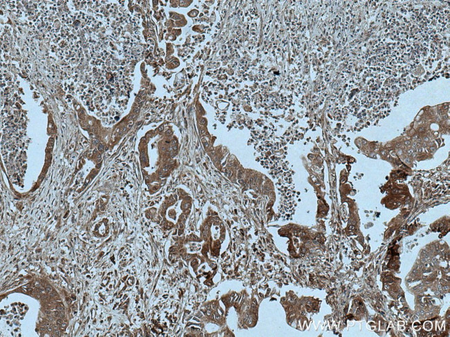 ASK1 Antibody in Immunohistochemistry (Paraffin) (IHC (P))