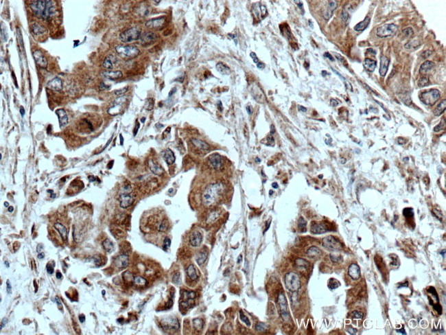 ASK1 Antibody in Immunohistochemistry (Paraffin) (IHC (P))