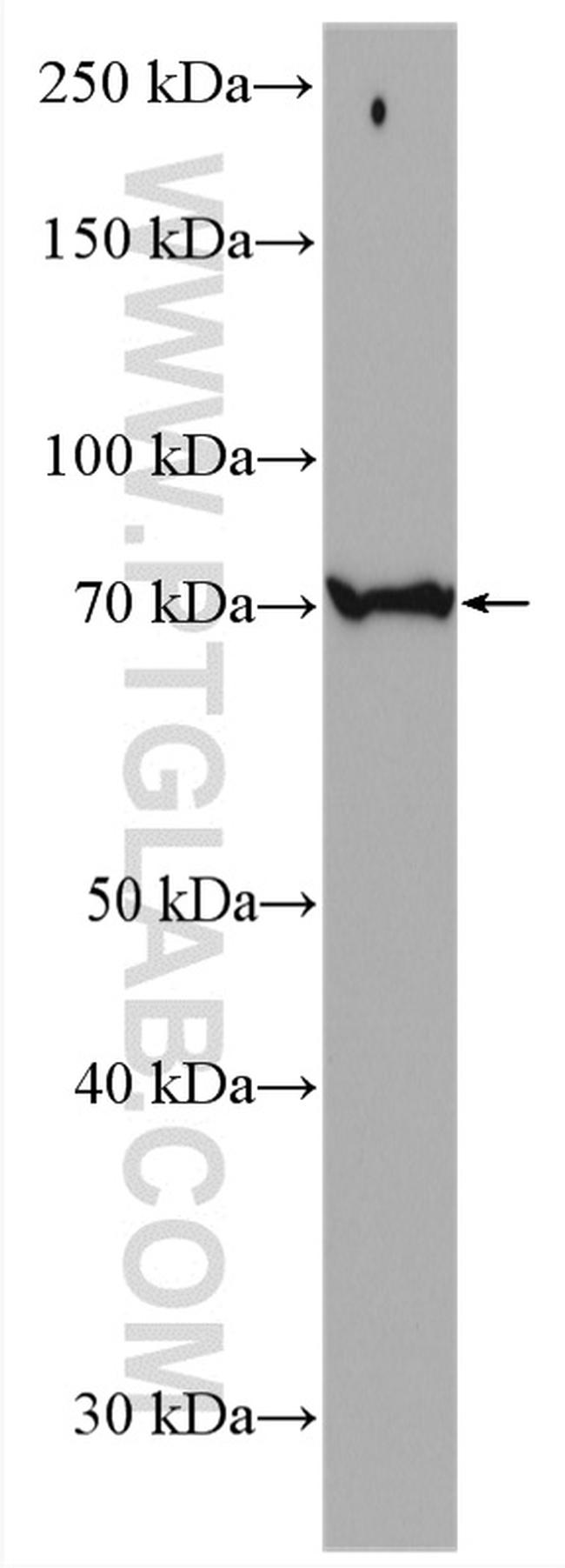 ASK1 Antibody in Western Blot (WB)