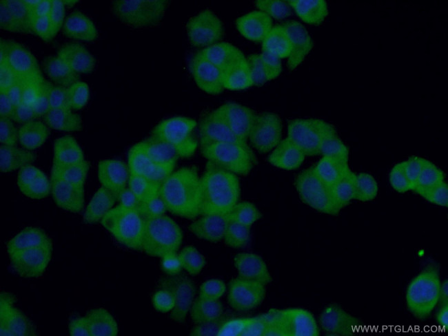 BDNF Antibody in Immunocytochemistry (ICC/IF)