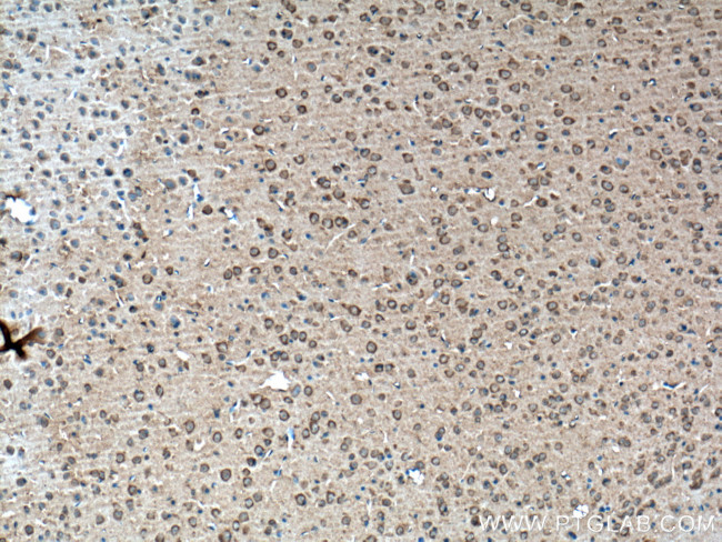 BDNF Antibody in Immunohistochemistry (Paraffin) (IHC (P))