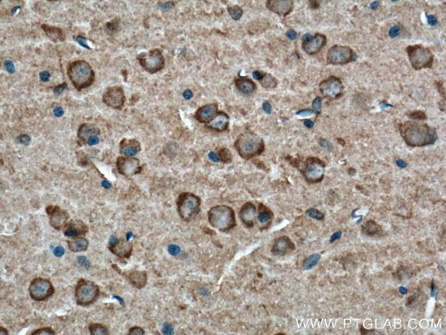 BDNF Antibody in Immunohistochemistry (Paraffin) (IHC (P))