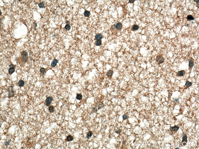 BDNF Antibody in Immunohistochemistry (Paraffin) (IHC (P))