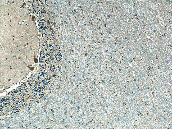 P2RX7 Antibody in Immunohistochemistry (Paraffin) (IHC (P))