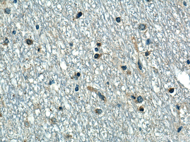 P2RX7 Antibody in Immunohistochemistry (Paraffin) (IHC (P))