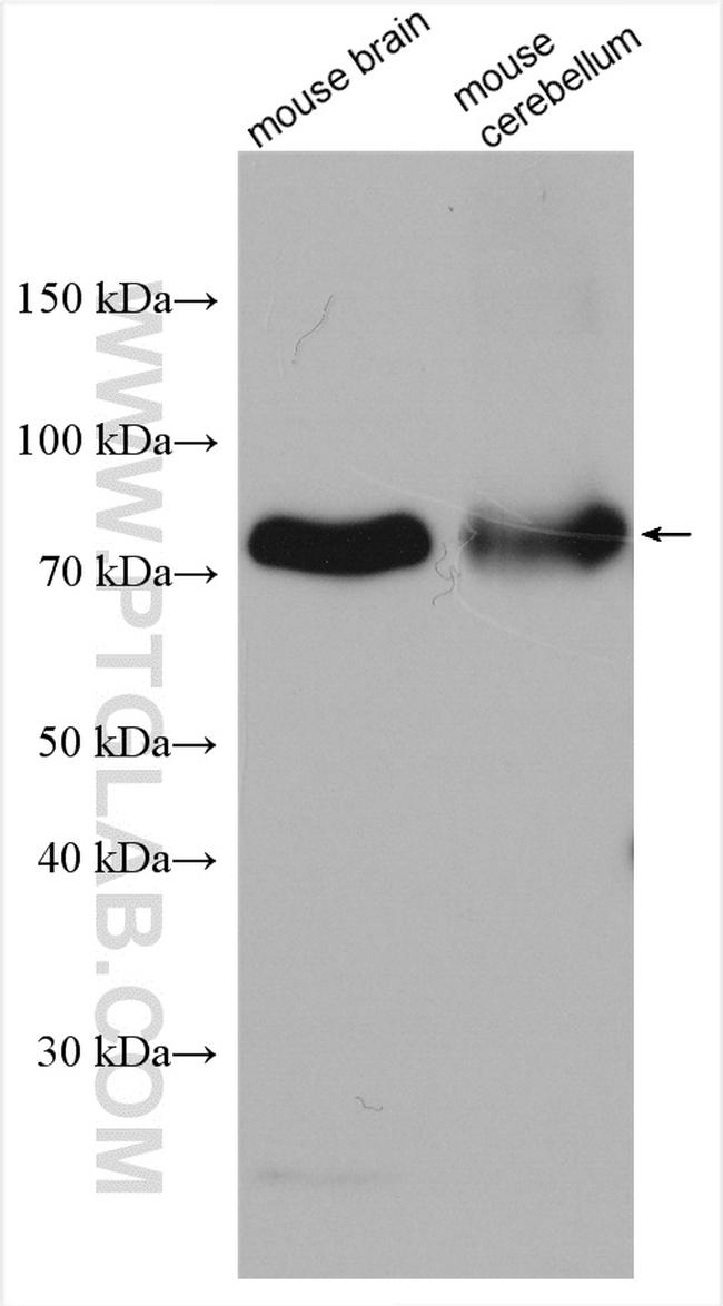 P2RX7 Antibody in Western Blot (WB)