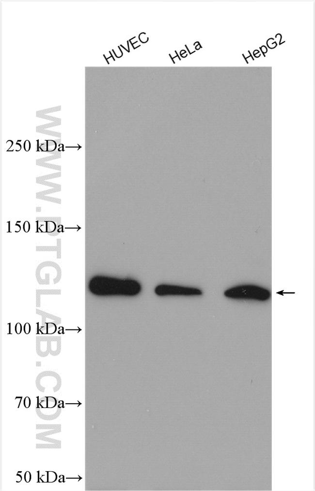 SREBF2 Antibody in Western Blot (WB)