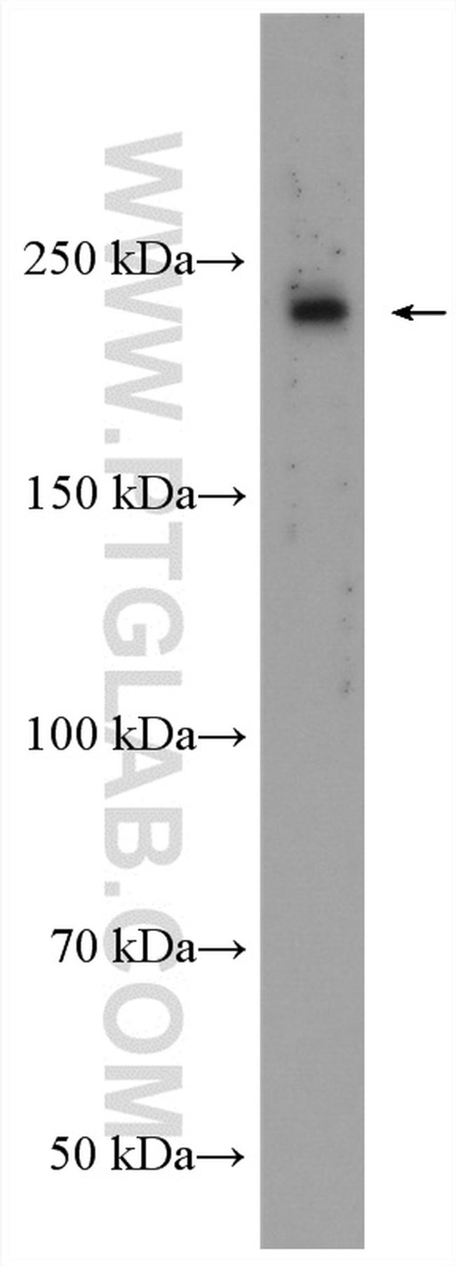 BZRAP1 Antibody in Western Blot (WB)