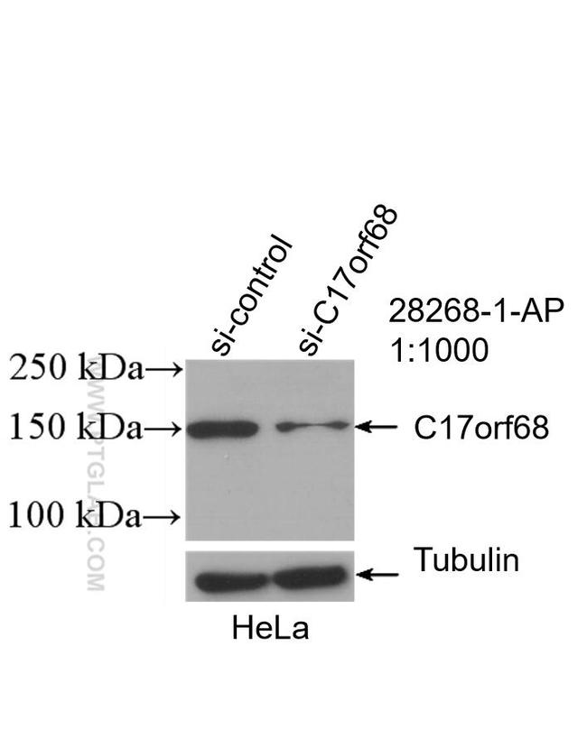 CTC1 Antibody in Western Blot (WB)