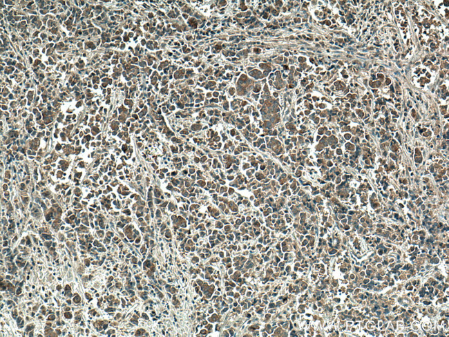 mTOR Antibody in Immunohistochemistry (Paraffin) (IHC (P))