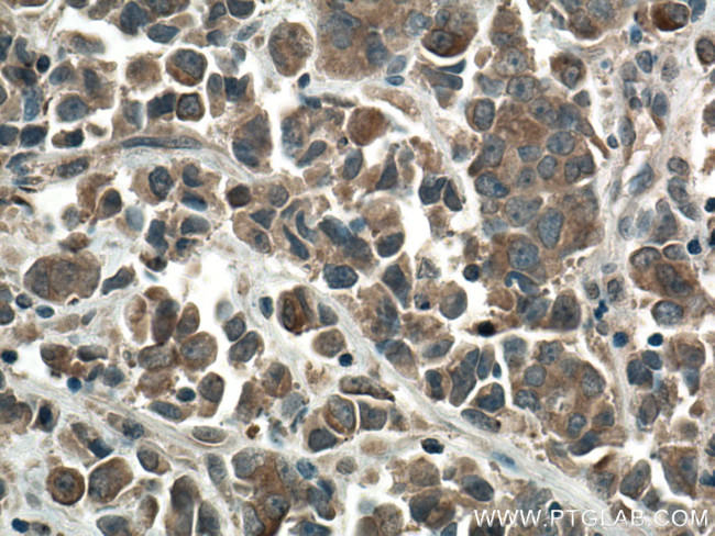 mTOR Antibody in Immunohistochemistry (Paraffin) (IHC (P))