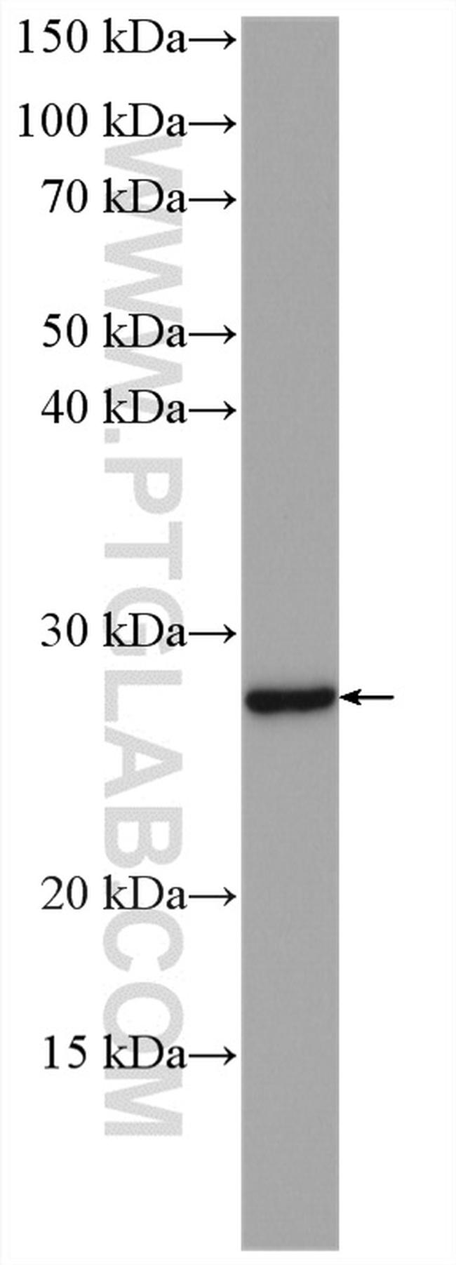 RAB17 Antibody in Western Blot (WB)