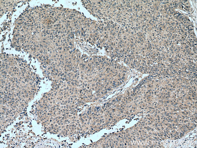 TSG101 Antibody in Immunohistochemistry (Paraffin) (IHC (P))