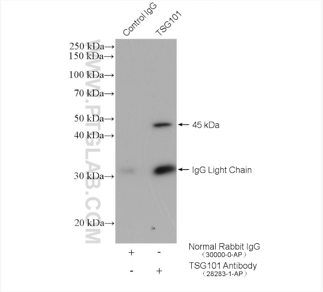 TSG101 Antibody in Immunoprecipitation (IP)