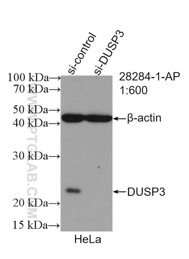 DUSP3 Antibody in Western Blot (WB)