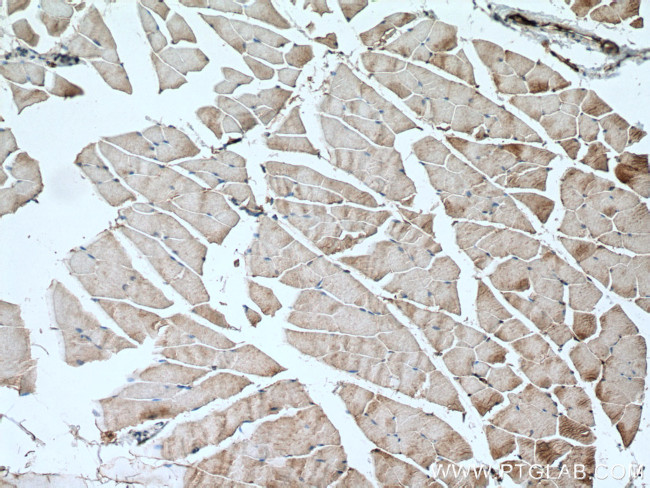 SCN4A Antibody in Immunohistochemistry (Paraffin) (IHC (P))