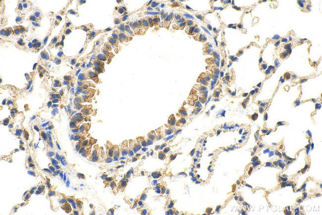 ADRB1 Antibody in Immunohistochemistry (Paraffin) (IHC (P))