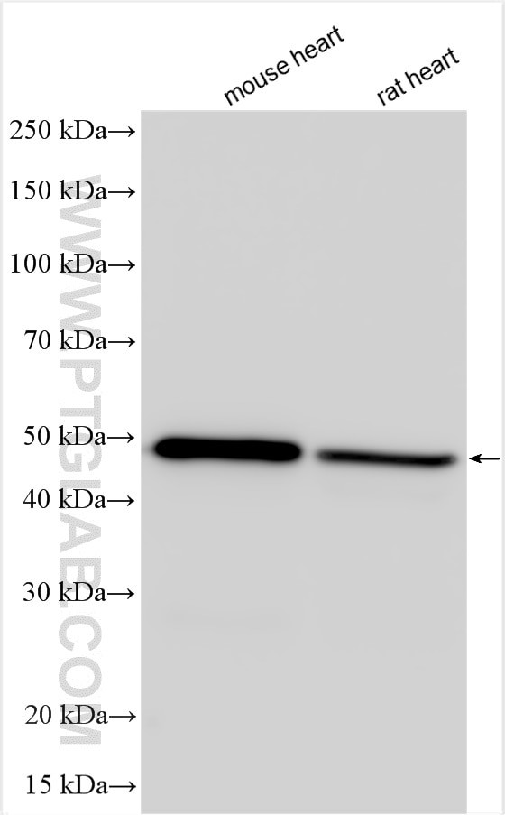 ADRB1 Antibody in Western Blot (WB)